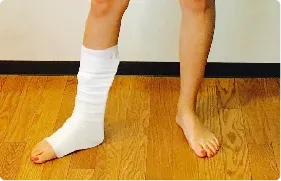 ガニ股歩行の写真