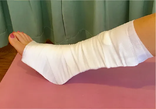 歩行ギプスで歩いて帰れる様子