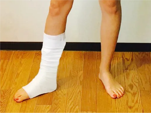 ガニ股歩行練習の写真